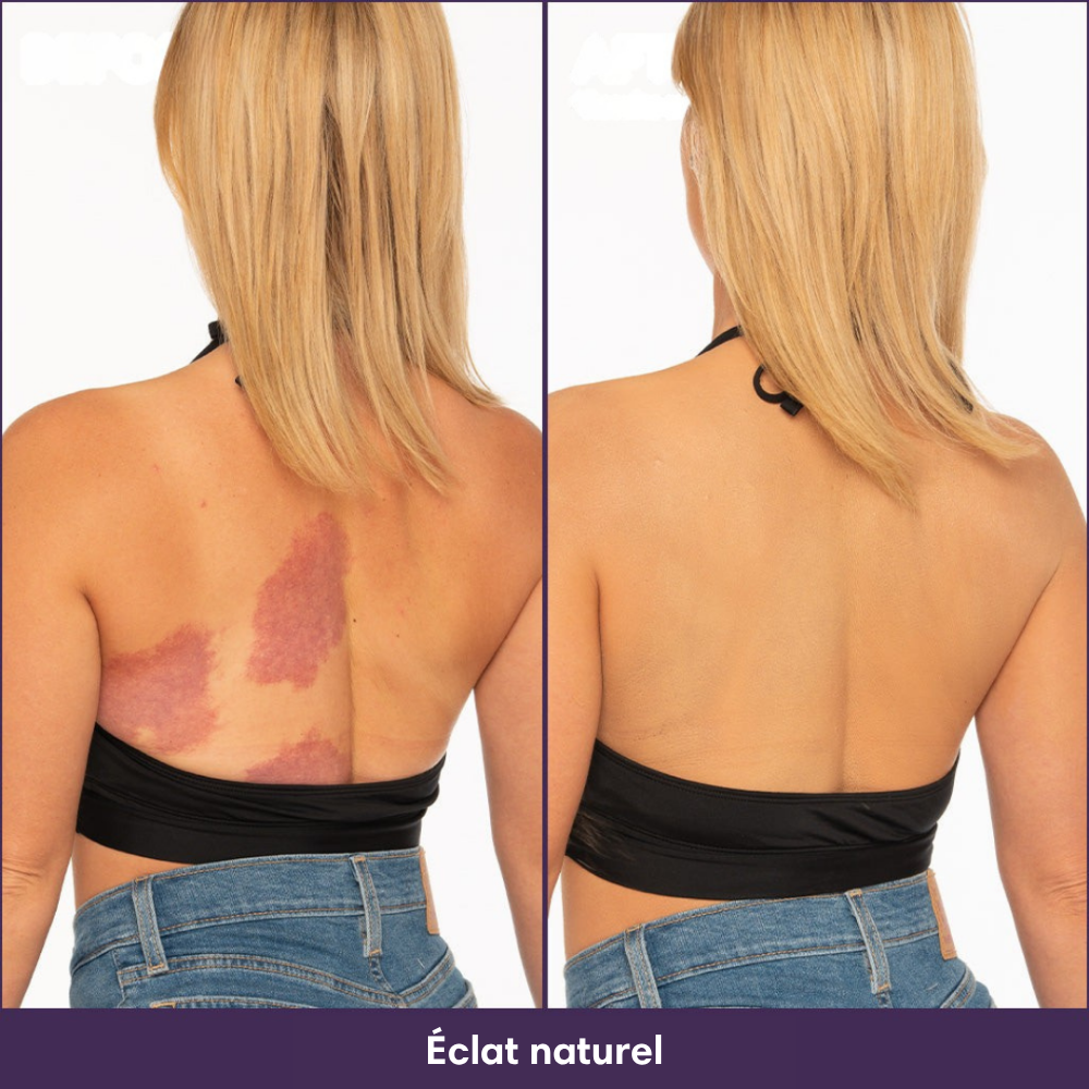 Perfecteur Corps™ – Fond de teint pour une peau uniforme