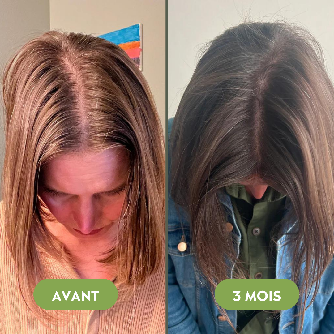Huile de croissance pour cheveux