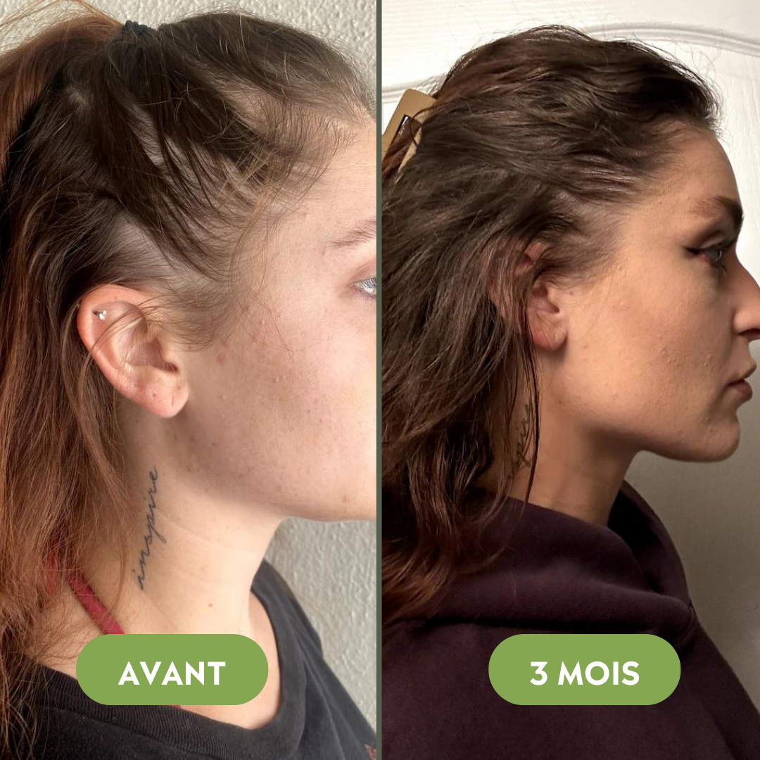 Huile de croissance pour cheveux