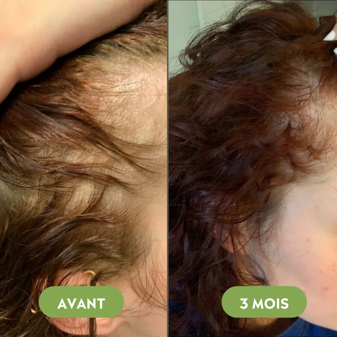 Huile de croissance pour cheveux