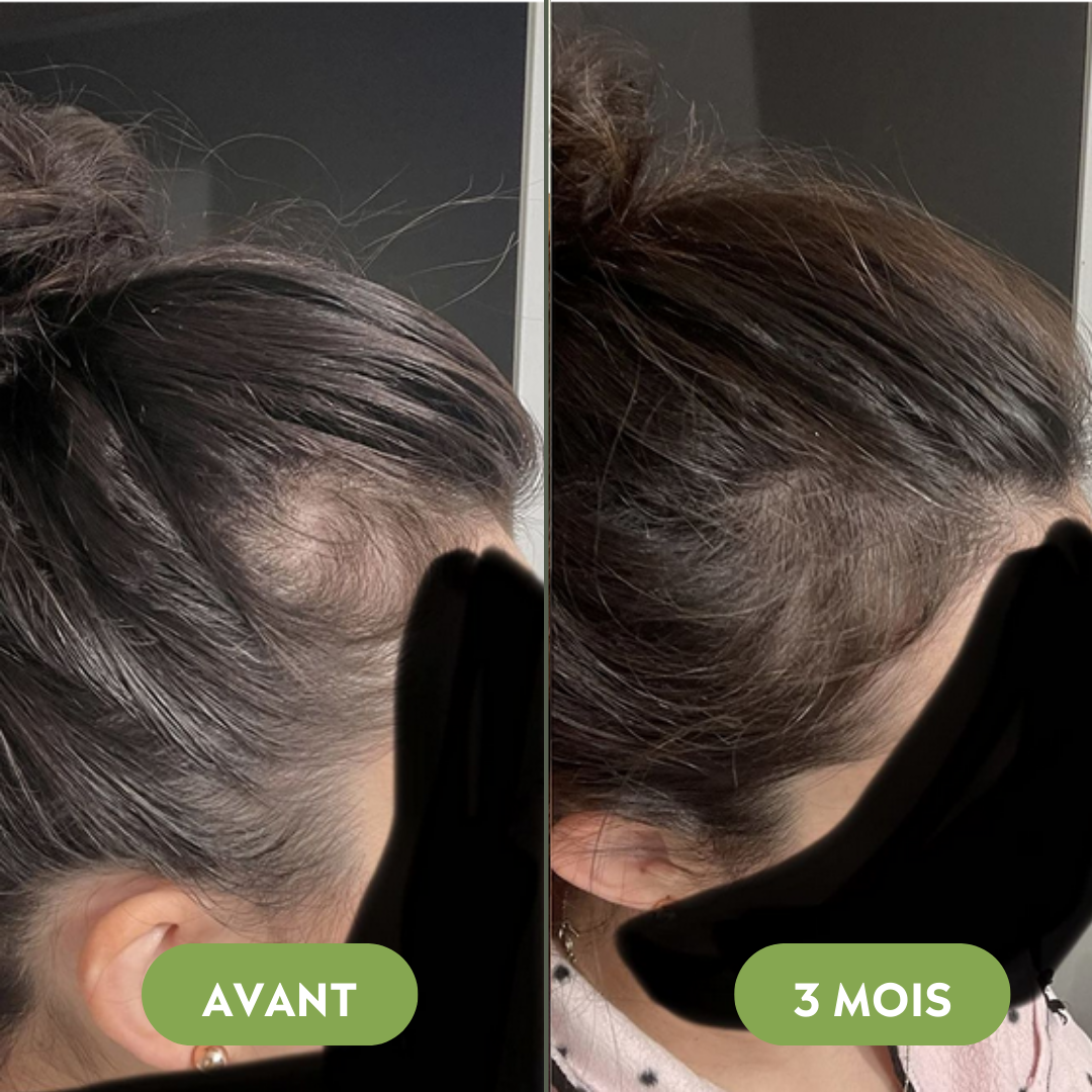 Huile de croissance pour cheveux