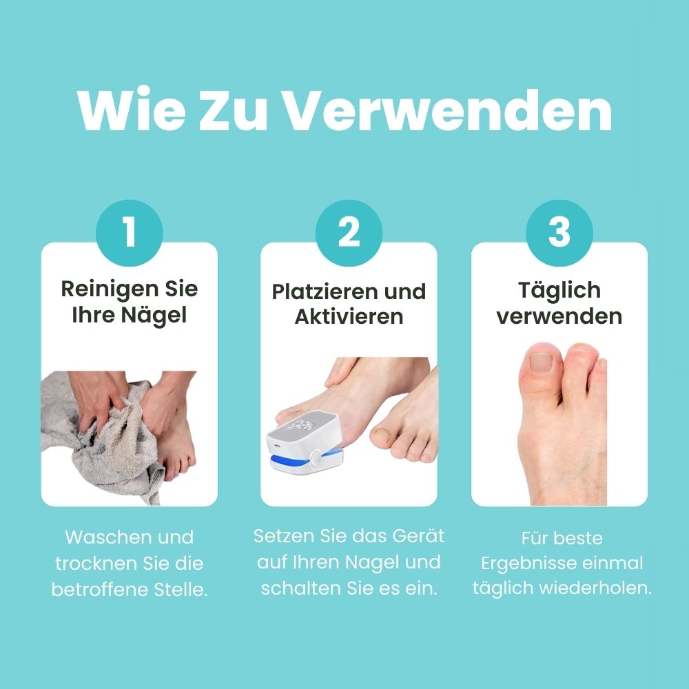 FungiClear Pro™ - Laser-Nagelpilz-Behandlung Gerät