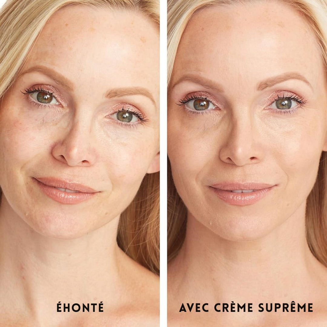 Couvrance Beauté d'Été