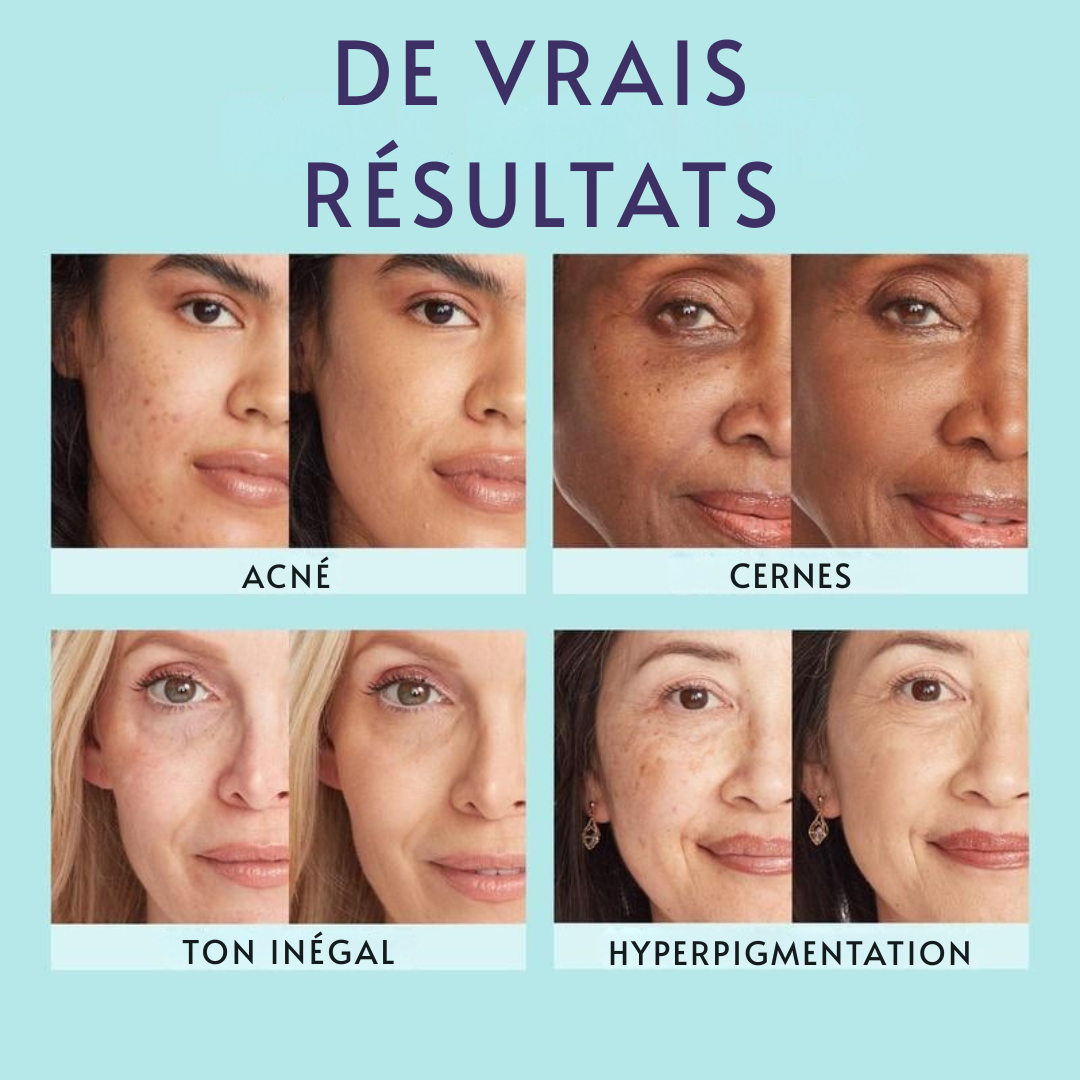 Couvrance Beauté d'Été