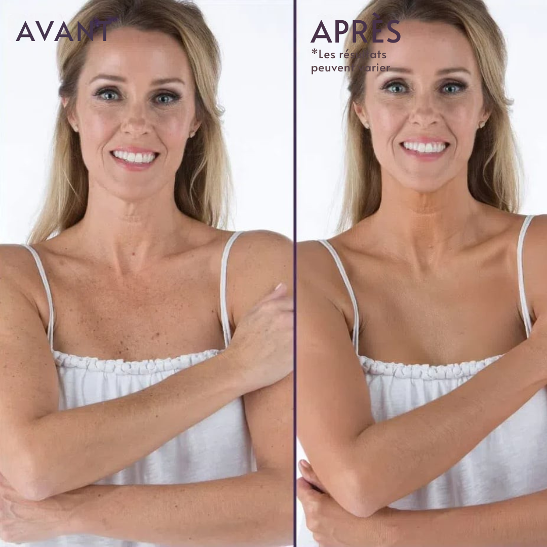 Couvrance Beauté d'Été