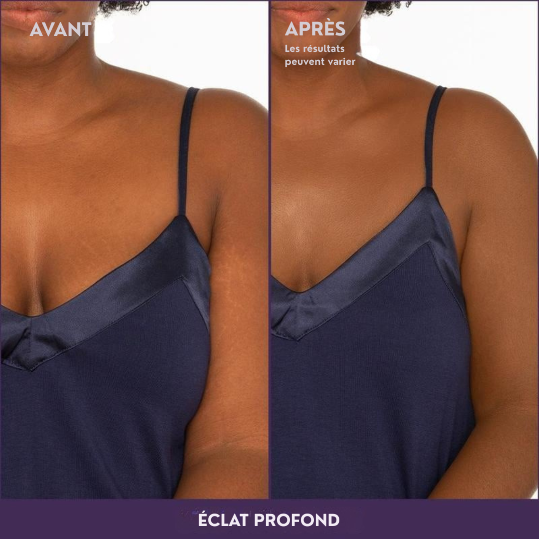 Couvrance Beauté d'Été