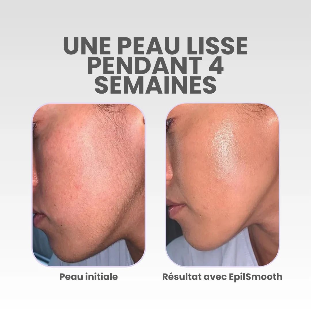 EpilSmooth⎪Épilateur visage