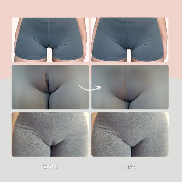 Elovya - String anti patte de chameau