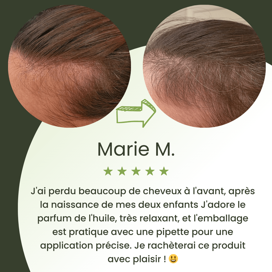 Huile de croissance pour cheveux