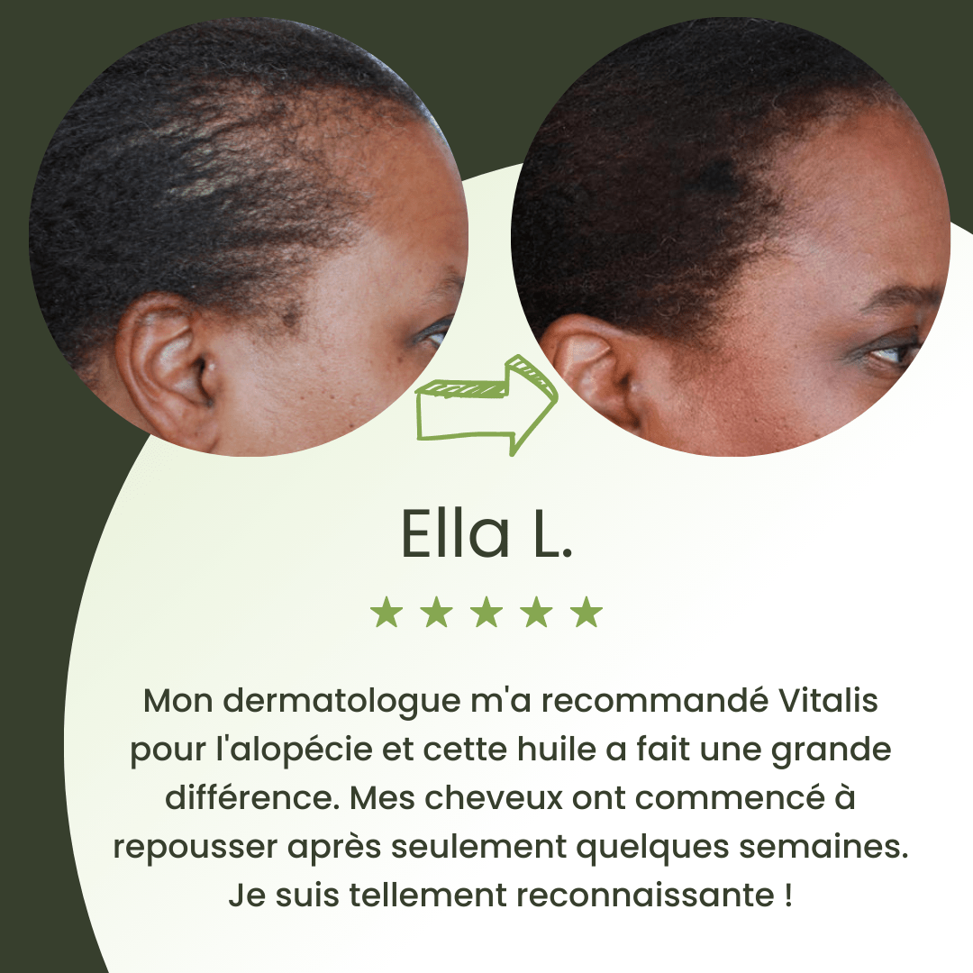 Huile de croissance pour cheveux
