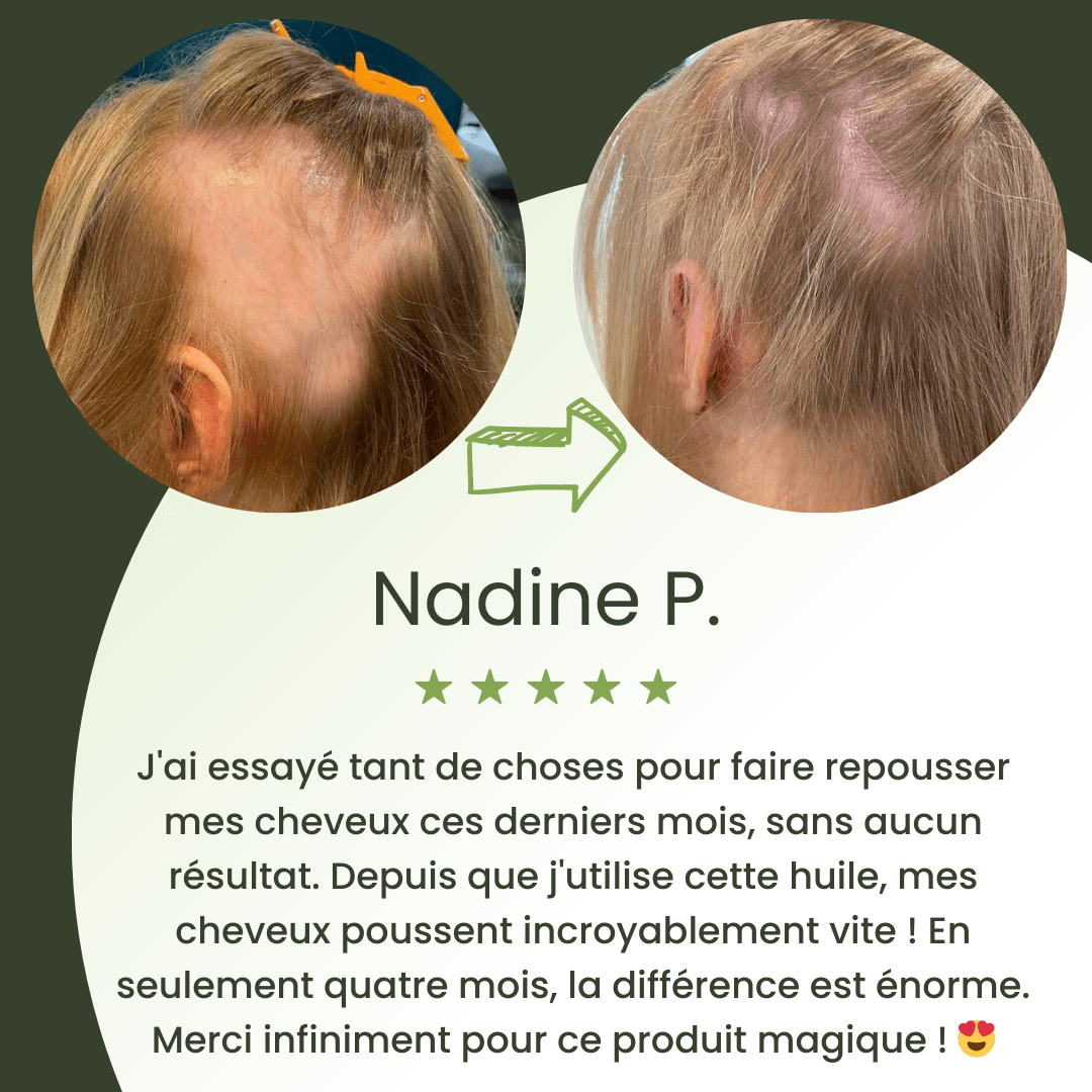 Huile de croissance pour cheveux