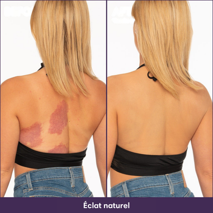 Perfecteur Corps™ – Fond de teint pour une peau uniforme