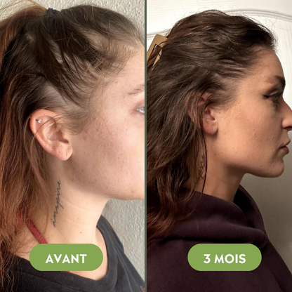 Huile de croissance pour cheveux