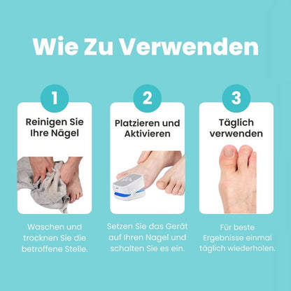 FungiClear Pro™ - Laser-Nagelpilz-Behandlung Gerät