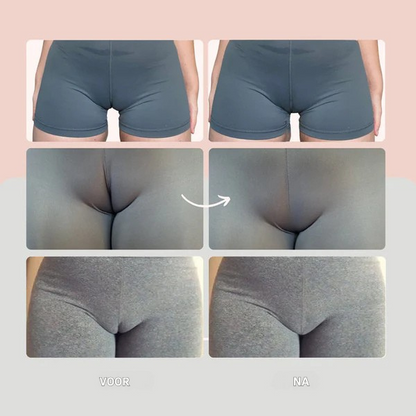 Elovya - String anti patte de chameau