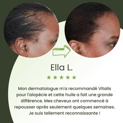 Huile de croissance pour cheveux