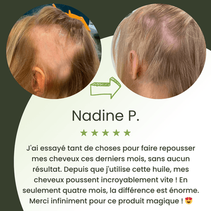 Huile de croissance pour cheveux